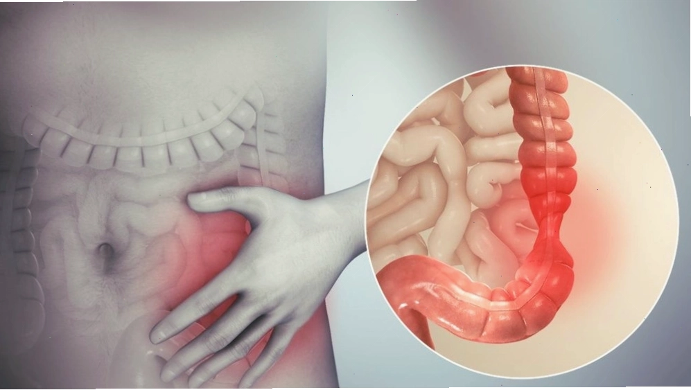 Thiền giúp giảm đáng kể các triệu chứng của hội chứng ruột kích thích